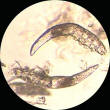 CLICK to see higher magnification of Demodex mites