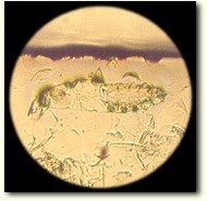 A Demodex mite near the edge of the microscope slide... high power view.